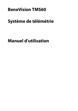 Mindray BeneVision TMS60 Tele Monitoring System Manuel utilisateur