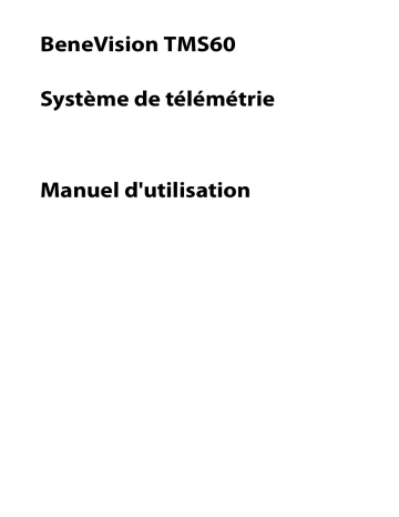 Mindray BeneVision TMS60 Tele Monitoring System Manuel utilisateur | Fixfr