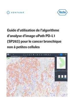 Roche uPath PD-L1 image analysis for NSCLC IVD Algorithm Manuel utilisateur