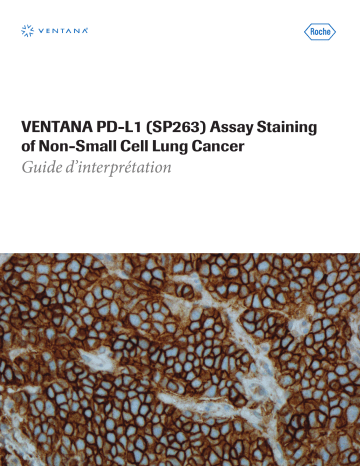 Roche VENTANA PD-L1 (SP263) Assay, Universal, CE IVD, Predictive, NSCLC Manuel utilisateur | Fixfr