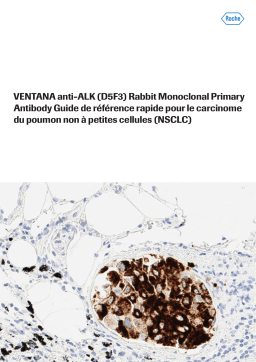 Roche VENTANA anti-ALK D5F3 Primary Antibody Manuel utilisateur