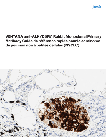 Roche VENTANA anti-ALK D5F3 Primary Antibody Manuel utilisateur | Fixfr