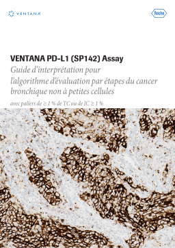 Roche VENTANA PD-L1 (SP142) Assay Manuel utilisateur