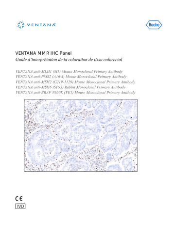 Roche Staining Colorectal Tissue for VENTANA MMR IHC Panel (OUS) Manuel utilisateur | Fixfr