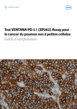 Roche VENTANA PD-L1 (SP263) Assay, Lung 1% cutoff, CE IVD, Predictive, NSCLC Manuel utilisateur