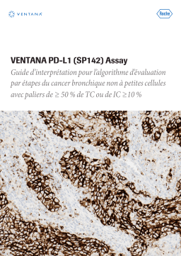 Roche NSCLC, VENTANA PD-L1 (SP142) Assay Manuel utilisateur