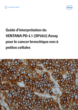 Roche VENTANA PD-L1 (SP263) Assay IVD W Manuel utilisateur