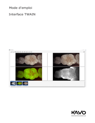 KaVo TWAIN Interface Mode d'emploi | Fixfr