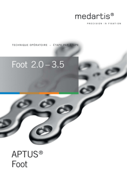 APTUS Foot 2.0-3.5 : Technique Opératoire + IA