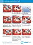 HemCon Pansement dentaire : Guide technique + IA