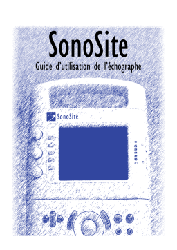 Guide d'utilisation de l'échographe SonoSite | AI Chat & PDF Access