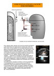 STR Universel Guide d'installation