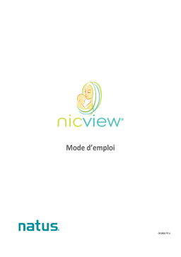 natus NICVIEW Mode d'emploi